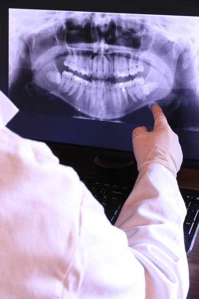 Best Emergency Gum Treatment in Cold Spring Harbor, NY