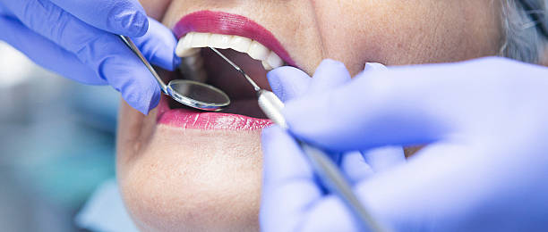 Best Emergency Dental Care for Broken or Chipped Teeth in Cold Spring Harbor, NY